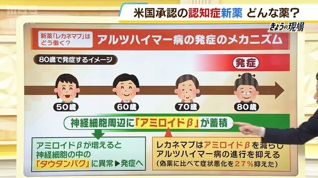 認知症の薬物療法 アルツハイマー型認知症ー治療（周辺症状）ー | 脳疾患を知る